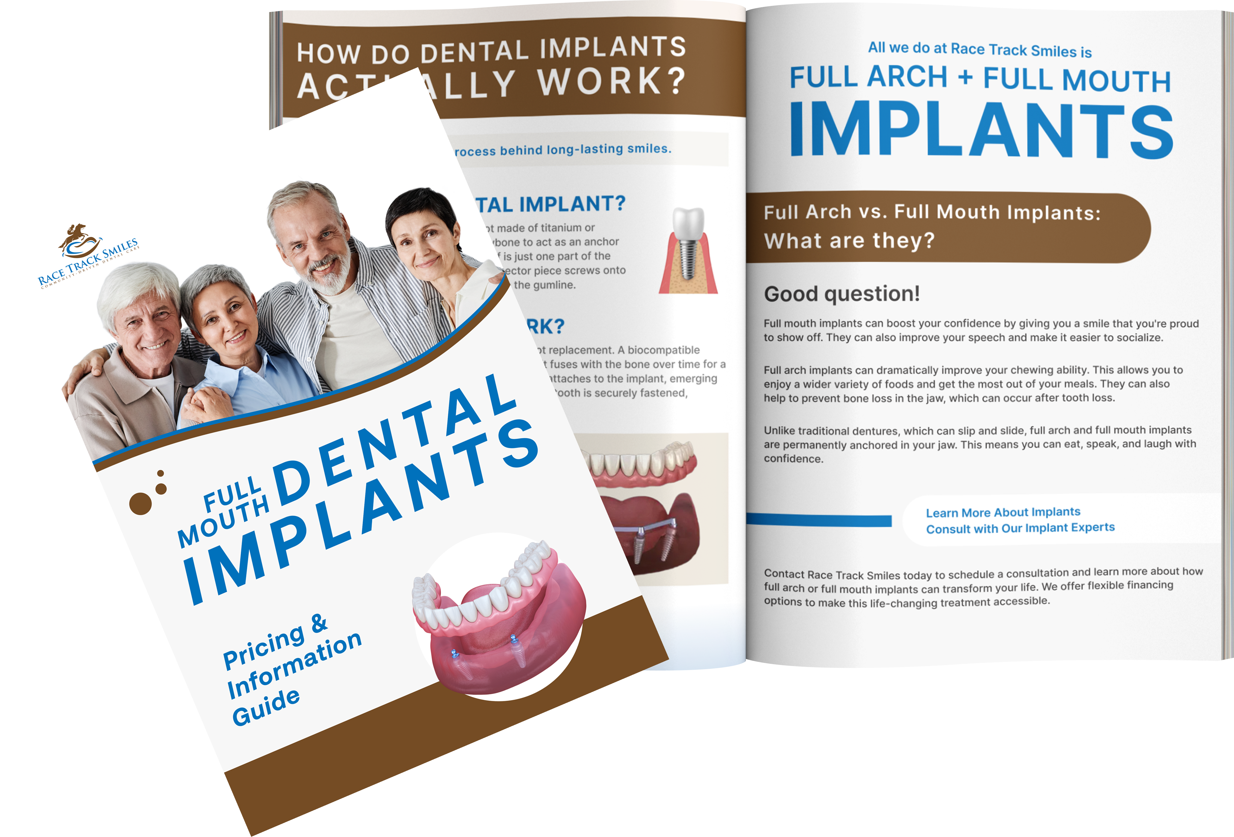 Race Track Smiles Dental Implant Pricing Guide